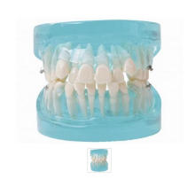 Orthodontic Model with Blue Transparent Jaw